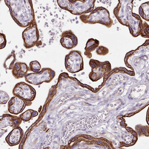 Immunohistochemical staining of human placenta shows cytoplasmic and membranous positivity in trophoblastic cells.