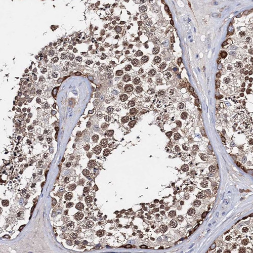 Immunohistochemical staining of human testis shows strong cytoplasmic and nuclear positivity in cells in seminiferous ducts.