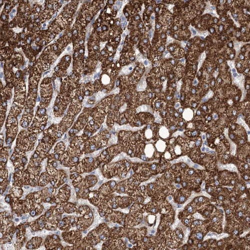 Immunohistochemical staining of human liver shows strong granular cytoplasmic positivity in hepatocytes.