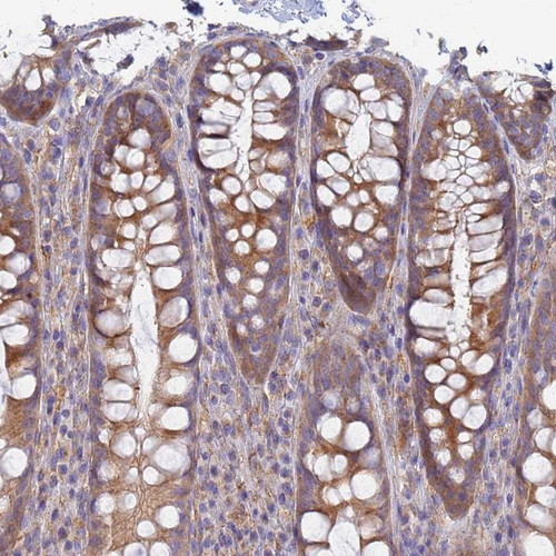 Immunohistochemical staining of human rectum shows moderate cytoplasmic positivity in glandular cells.