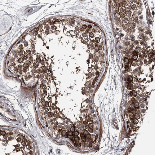 Immunohistochemical staining of human testis shows strong cytoplasmic positivity in cells in seminiferus ducts of testis.