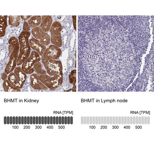 Immunohistochemistry analysis in human kidney and lymph node tissues using HPA038285 antibody. Corresponding BHMT RNA-seq data are presented for the same tissues.