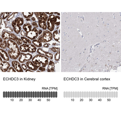 Immunohistochemistry analysis in human kidney and cerebral cortex tissues using Anti-ECHDC3 antibody. Corresponding ECHDC3 RNA-seq data are presented for the same tissues.
