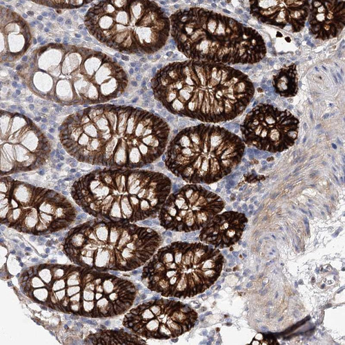 Immunohistochemical staining of human colon shows strong cytoplasmic and membranous positivity in glandular cells.