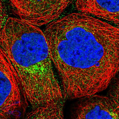 Immunofluorescent staining of human cell line A-431 shows localization to nucleoplasm & vesicles.