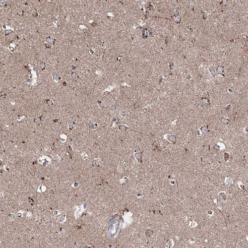 Immunohistochemical staining of human cerebral cortex shows granular cytoplasmic positivity in neuronal cells.