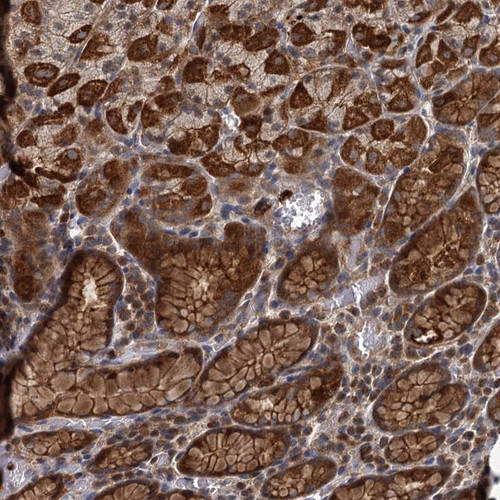 Immunohistochemical staining of human stomach shows strong cytoplasmic and membranous positivity in glandular cells.