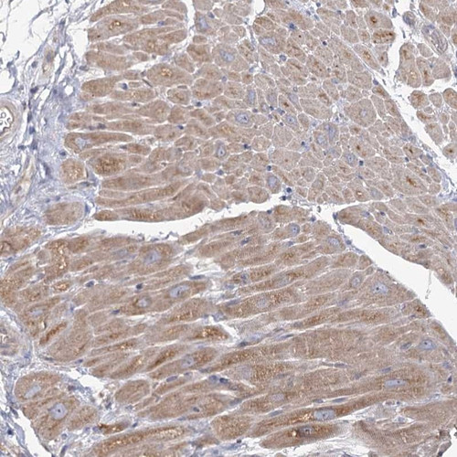 Immunohistochemical staining of human heart muscle shows moderate cytoplasmic positivity in myocytes.