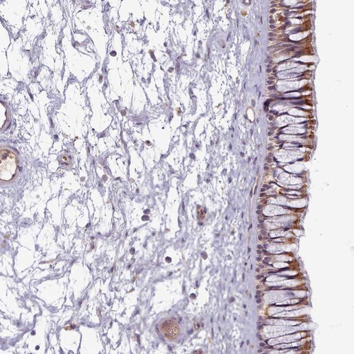 Immunohistochemical staining of human nasopharynx shows moderate cytoplasmic positivity in respiratory epithelial cells.