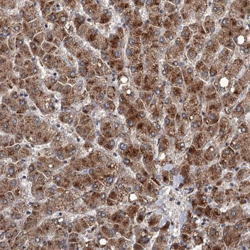 Immunohistochemical staining of human liver shows strong cytoplasmic positivity in hepatocytes.