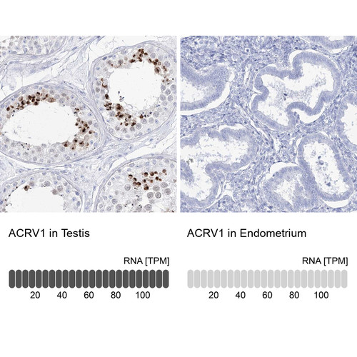 Immunohistochemistry analysis in human testis and endometrium tissues using Anti-ACRV1 antibody. Corresponding ACRV1 RNA-seq data are presented for the same tissues.