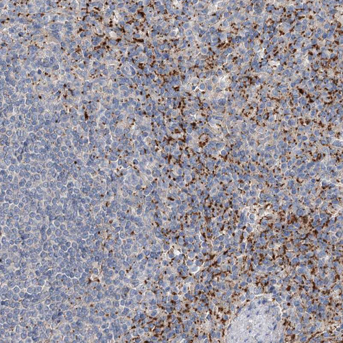 Immunohistochemical staining of human spleen shows strong membranous positivity in cells in red pulp.