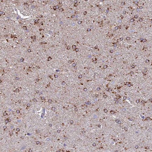 Immunohistochemical staining of human cerebral cortex shows strong cytoplasmic positivity in glial cells. 