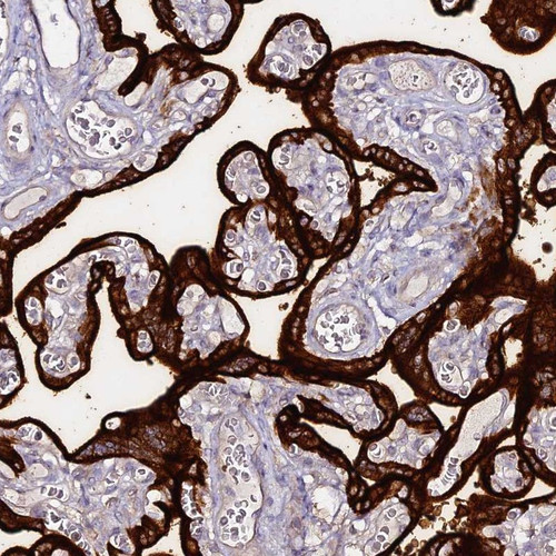 Immunohistochemical staining of human placenta shows strong cytoplasmic and membranous staining in trophoblasts.