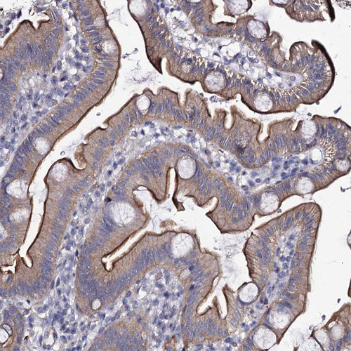 Immunohistochemical staining of human colon shows moderate membranous positivity in glandular cells.