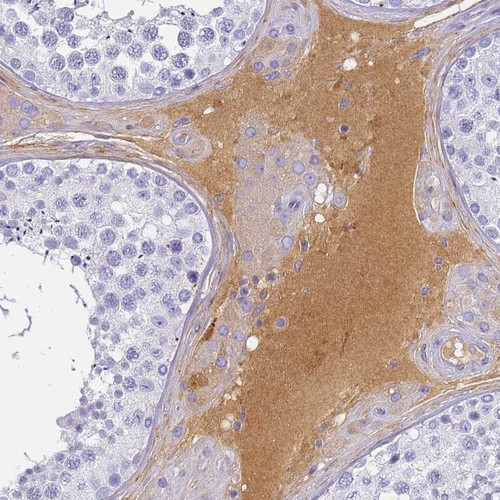 Immunohistochemical staining of human testis shows positivity in plasma. 