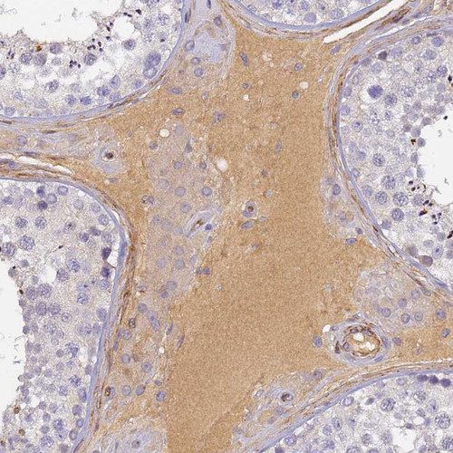 Immunohistochemical staining of human testis shows moderate extracellular space positivity in Leydig cells.