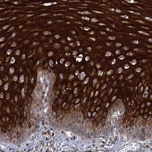 Immunohistochemical staining of human esophagus shows strong cytoplasmic and membranous positivity in squamous epithelial cells.