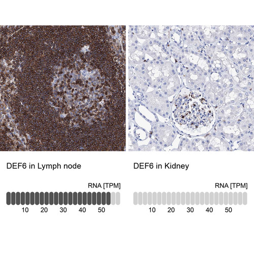 Immunohistochemistry analysis in human lymph node and kidney tissues using Anti-DEF6 antibody. Corresponding DEF6 RNA-seq data are presented for the same tissues.