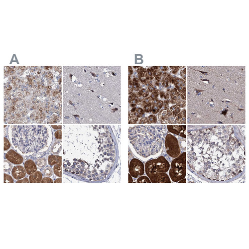 Immunohistochemical staining of human adrenal gland, cerebral cortex, kidney and testis using Anti-CLPB antibody HPA039005 (A) shows similar protein distribution across tissues to independent antibody HPA039006 (B).