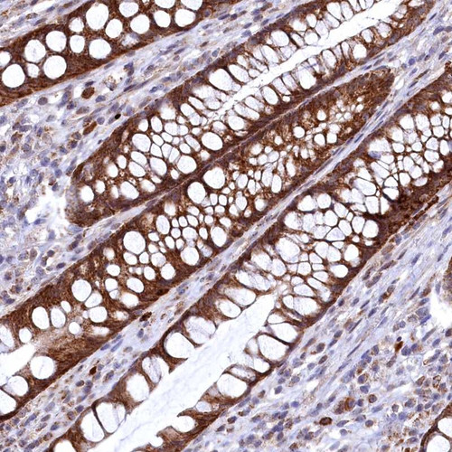 Immunohistochemical staining of human rectum shows strong cytoplasmic positivity in glandular cells.