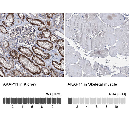 Immunohistochemistry analysis in human kidney and skeletal muscle tissues using Anti-AKAP11 antibody. Corresponding AKAP11 RNA-seq data are presented for the same tissues.