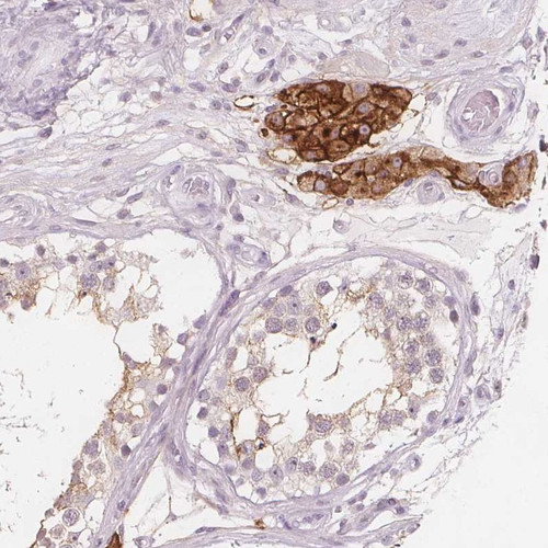 Immunohistochemical staining of human testis shows strong membranous positivity in Leydig cells.