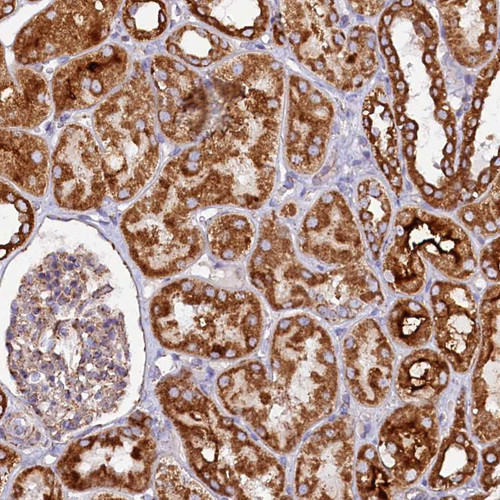 Immunohistochemical staining of human kidney shows strong cytoplasmic positivity in cells in tubules.