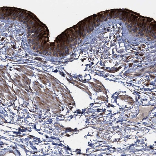 Immunohistochemical staining of human bronchus shows strong cytoplasmic and membranous positivity in respiratory epithelial cells.
