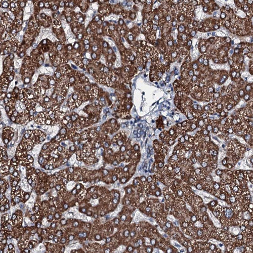 Immunohistochemical staining of human liver shows STRONG CYTOPLASMIC positivity in hepatocytes.