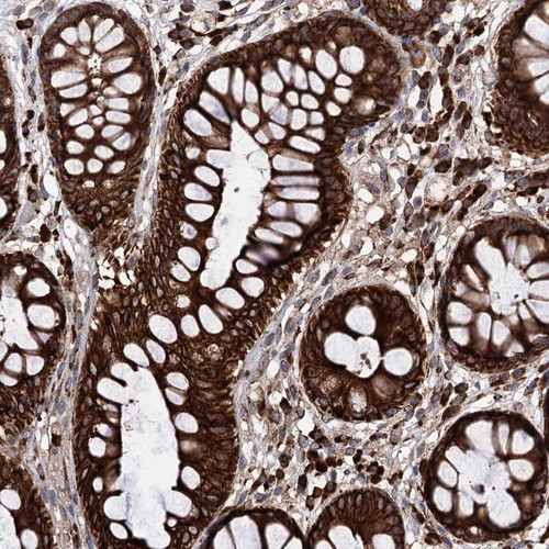 Immunohistochemical staining of human rectum shows strong cytoplasmic and membranous positivity in glandular cells.