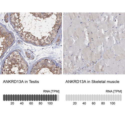 Immunohistochemistry analysis in human testis and skeletal muscle tissues using Anti-ANKRD13A antibody. Corresponding ANKRD13A RNA-seq data are presented for the same tissues.