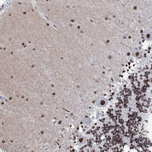 Immunohistochemical staining of human cerebellum shows strong nuclear positivity in purkinje cells.