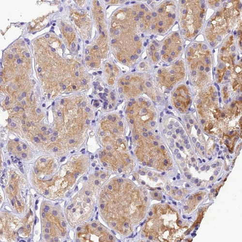 Immunohistochemical staining of human kidney shows moderate cytoplasmic positivity in renal tubules.