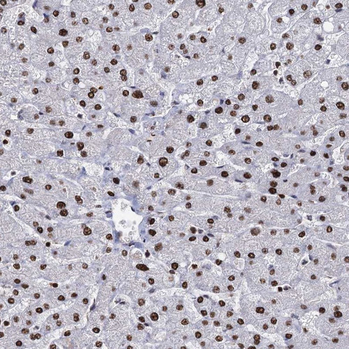 Immunohistochemical staining of human liver shows strong nuclear positivity in hepatocytes.