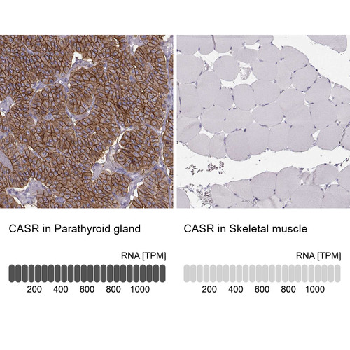 Immunohistochemistry analysis in human parathyroid gland and skeletal muscle tissues using HPA039686 antibody. Corresponding CASR RNA-seq data are presented for the same tissues.