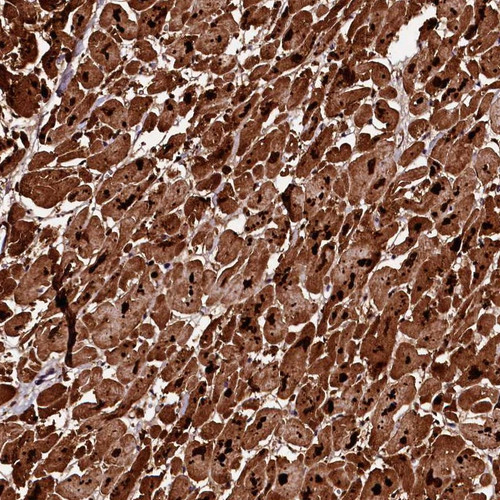 Immunohistochemical staining of human heart muscle shows strong cytoplasmic positivity in myocytes.