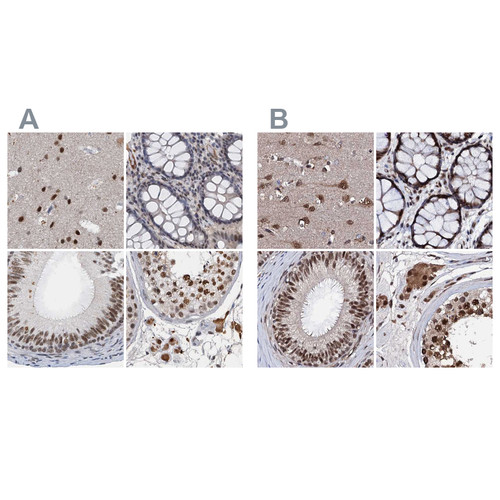 Immunohistochemical staining of human cerebral cortex, colon, epididymis and testis using Anti-CSTF3 antibody HPA039743 (A) shows similar protein distribution across tissues to independent antibody HPA040168 (B).