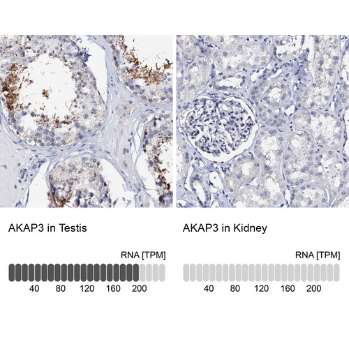Immunohistochemistry analysis in human testis and kidney tissues using Anti-AKAP3 antibody. Corresponding AKAP3 RNA-seq data are presented for the same tissues.