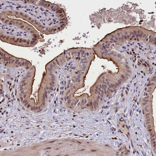 Immunohistochemical staining of human gallbladder shows cytoplasmic and luminal positivity in glandular cells.