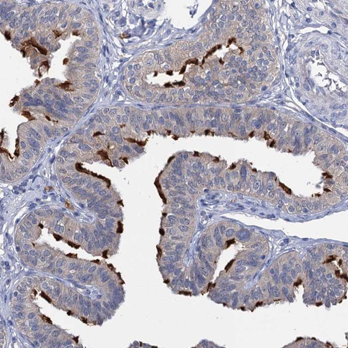 Immunohistochemical staining of human fallopian tube shows distinct positivity in ciliated cells.