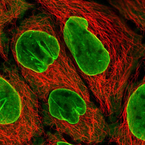 Immunofluorescent staining of human cell line CACO-2 shows localization to nuclear membrane & cytosol.