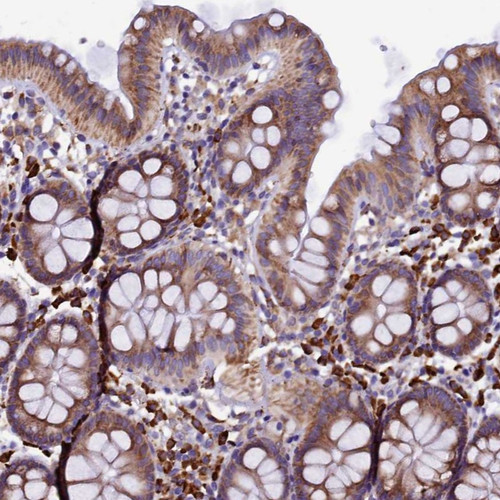 Immunohistochemical staining of human colon shows moderate cytoplasmic positivity in glandular cells.