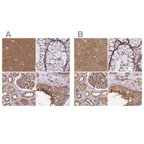Immunohistochemical staining of human cerebral cortex, colon, kidney and testis using Anti-DCTN2 antibody HPA040040 (A) shows similar protein distribution across tissues to independent antibody HPA039715 (B).