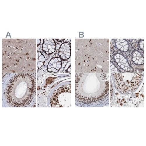 Immunohistochemical staining of human cerebral cortex, colon, epididymis and testis using Anti-CSTF3 antibody HPA040168 (A) shows similar protein distribution across tissues to independent antibody HPA039743 (B).