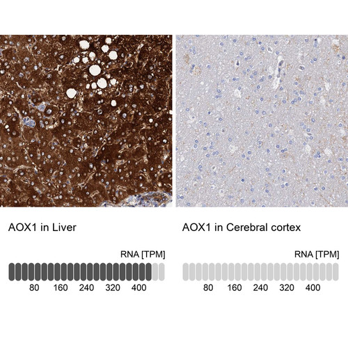 Immunohistochemistry analysis in human liver and cerebral cortex tissues using Anti-AOX1 antibody. Corresponding AOX1 RNA-seq data are presented for the same tissues.