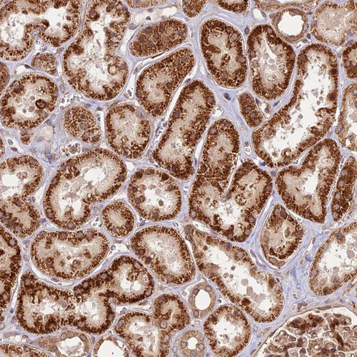 Immunohistochemical staining of human kidney shows strong cytoplasmic positivity in tubular cells.