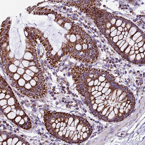 Immunohistochemical staining of human colon shows strong cytoplasmic positivity with granular pattern in glandular cells.