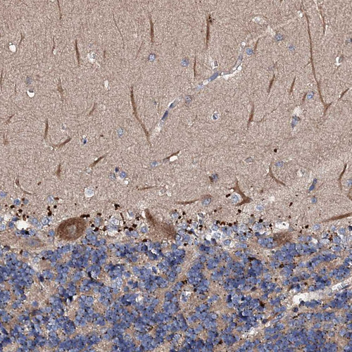 Immunohistochemical staining of human cerebellum shows moderate cytoplasmic positivity in Purkinje cells.