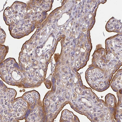 Immunohistochemical staining of human placenta shows moderate cytoplasmic and membranous positivity in trophoblastic cells.